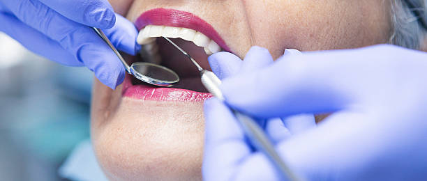 Best Emergency Dental Care for Broken or Chipped Teeth in Willard, OH