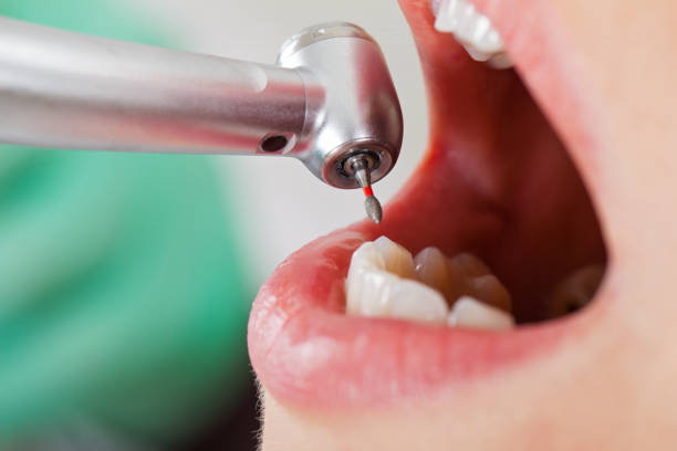 Best Emergency Denture Repair in Willard, OH